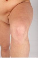 Knee texture of Casey 0002